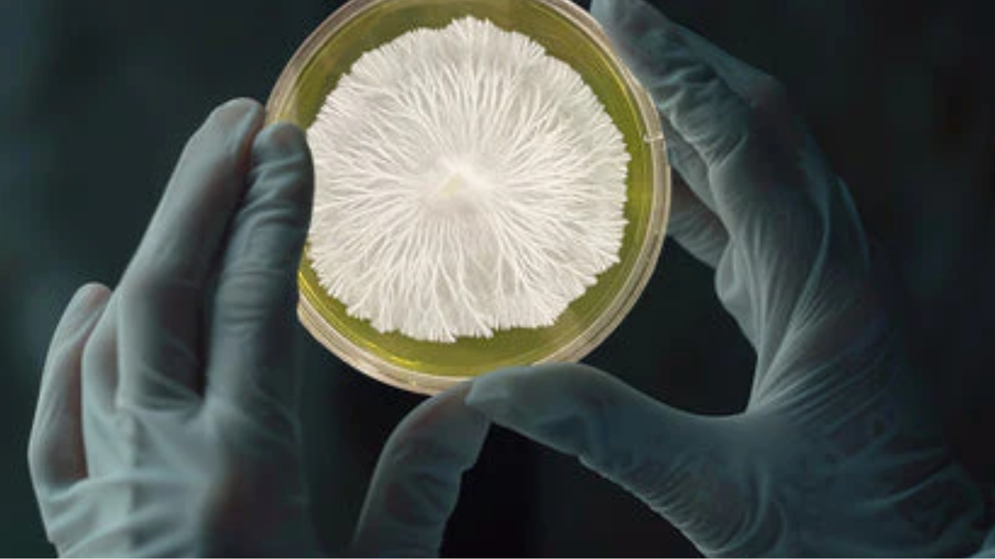 Hand holding agar plate with myceliuym